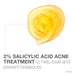 Neutrogena Oil-Free Acne Wash with Salicylic Acid - 6 fl oz - Shop Home Med