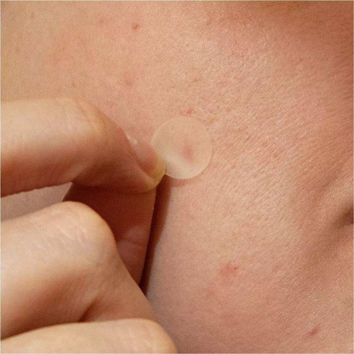 PanOxyl PM Patch - Shop Home Med