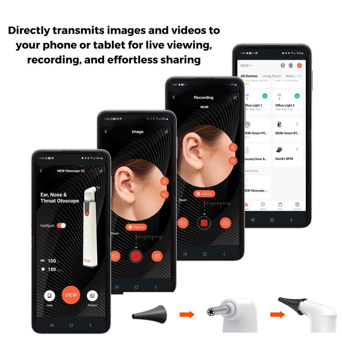 Mobi Smart Ear Nose and Throat Otoscope HD Camera