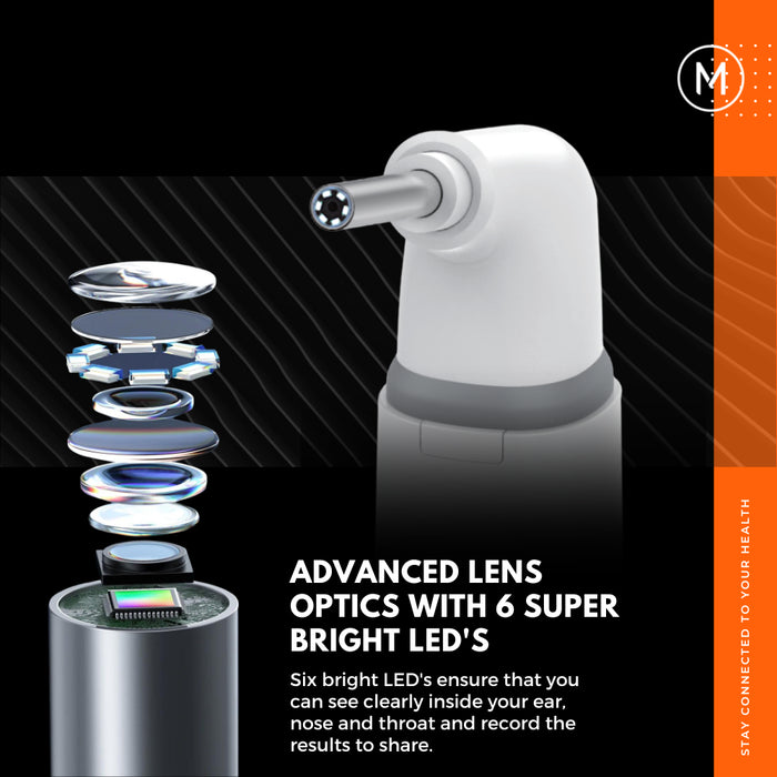 Mobi Smart Ear Nose and Throat Otoscope HD Camera
