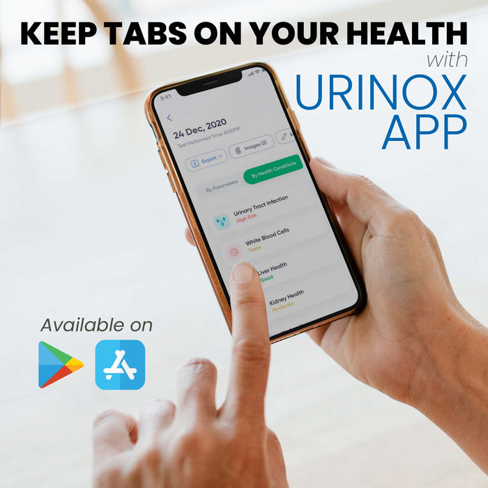 Diagnox Urinox-10 Urinalysis Test Strips