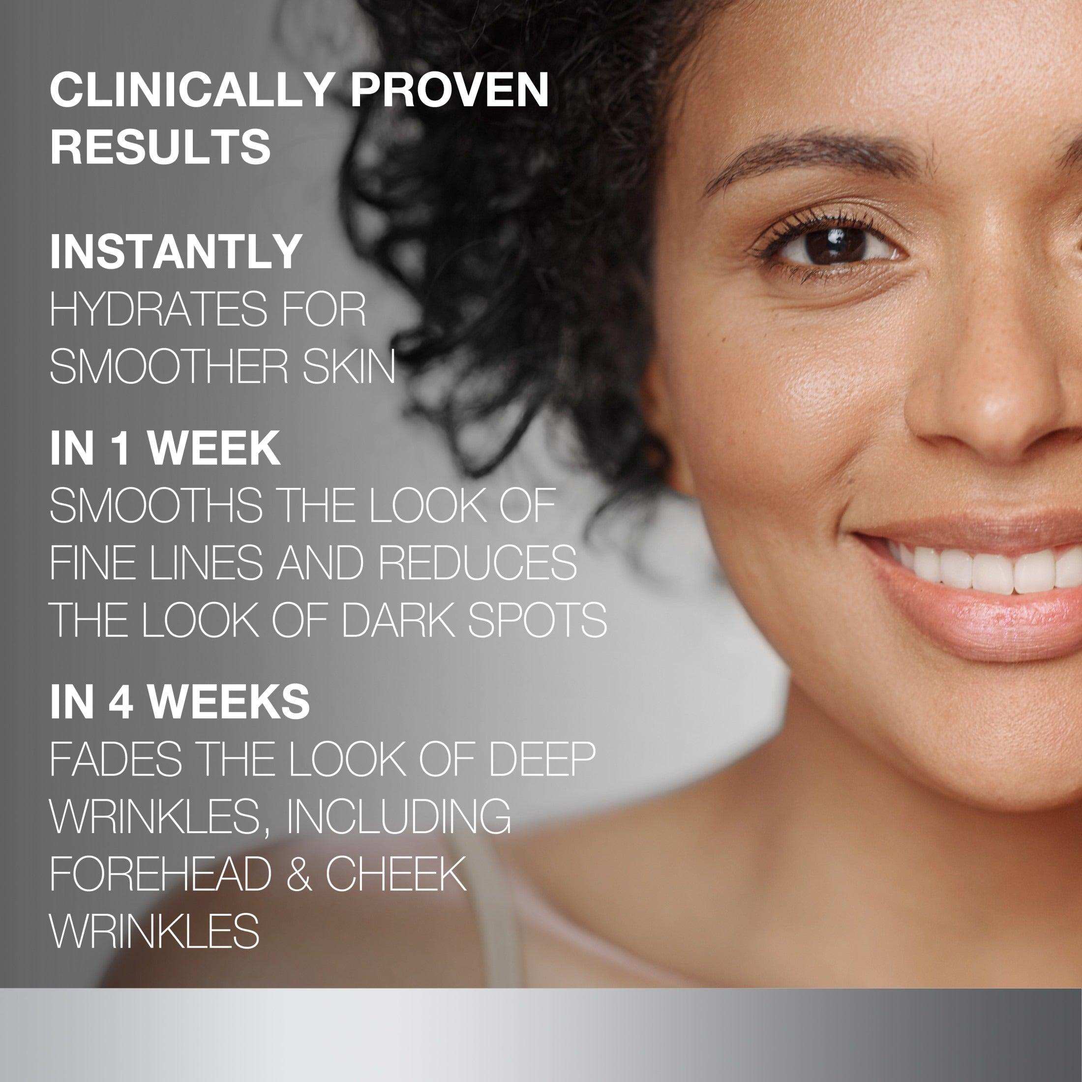 Neutrogena Rapid Wrinkle Repair Anti-Wrinkle Retinol Cream - 1.7 oz - Shop Home Med