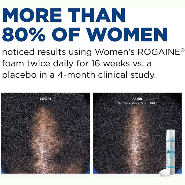 Rogaine Women's Hair Regrowth 5% Minoxidil Foam - 2 Month Supply