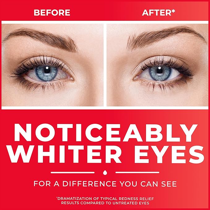 Clear Eyes Redness Relief Drops