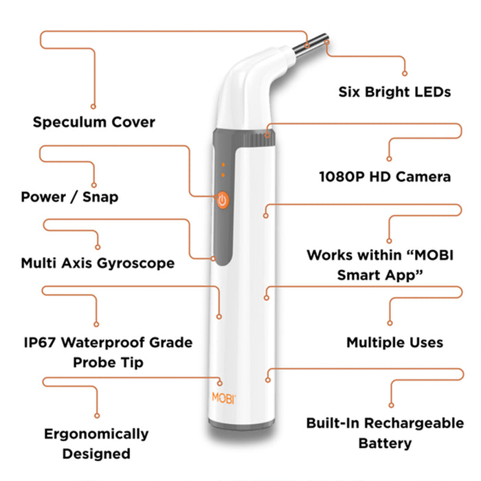Mobi Smart Ear Nose and Throat Otoscope HD Camera