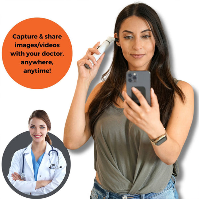 Mobi Smart Ear Nose and Throat Otoscope HD Camera