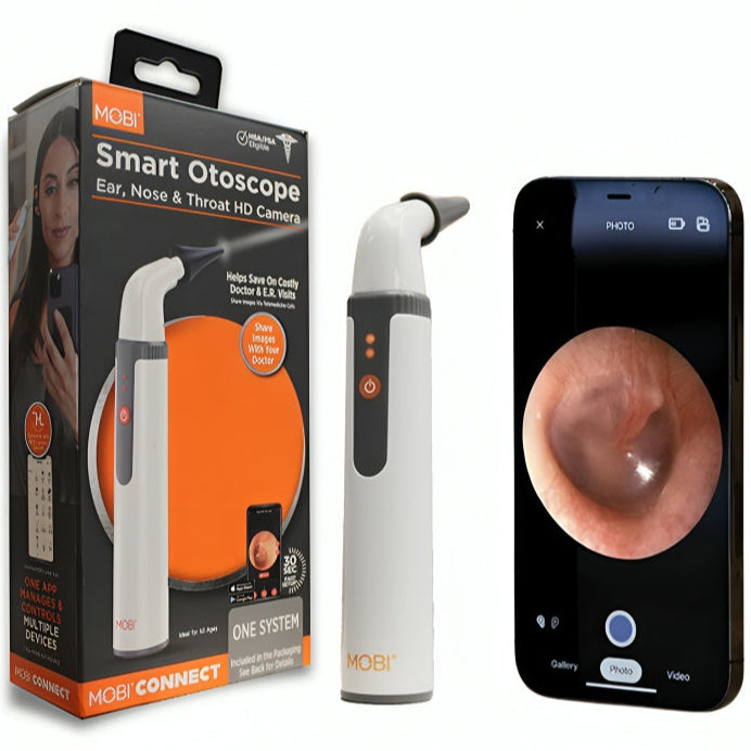Mobi Smart Ear Nose and Throat Otoscope HD Camera